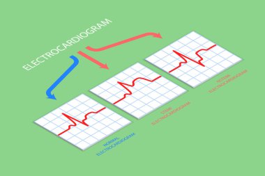 3D Isometric Düz Vektör Elektrokardiyogram, Teşhis ve Sağlık Resimleri