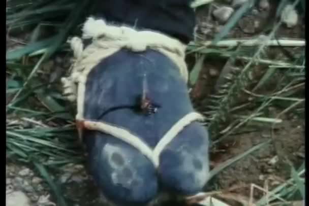 Крупный План Травмированных Ног После Наступления Шипы — стоковое видео