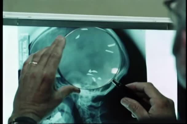 Закрыть Вид Руки Держащие Увеличительное Стекло Над Рентгенограммой — стоковое видео