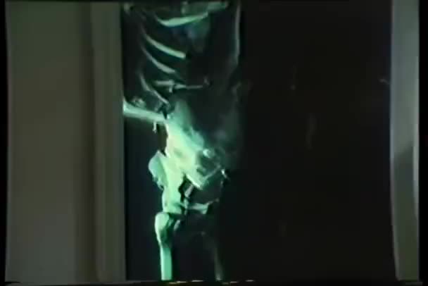 Akasztott Csontváz Tartja Koponya Háttérben Közelről — Stock videók