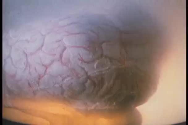 Zoom Auf Gehirn Das Krug Schwimmt — Stockvideo