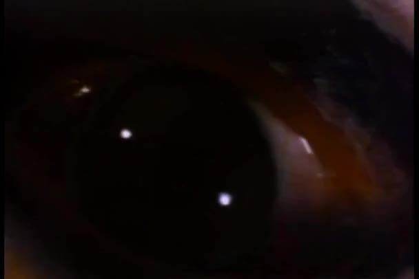 Bliska Miga Przekrwione Oko — Wideo stockowe