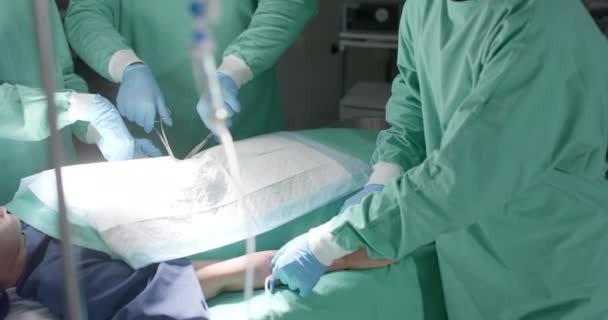 수술중에 마스크를 수술중에 동작으로 얼굴을 가리는 의사들이 — 비디오