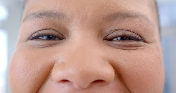 Portrett Lykkelige Øyne Afrikansk Amerikansk Kvinne Sykehus Sakte Bevegelse Medisin – stockvideo