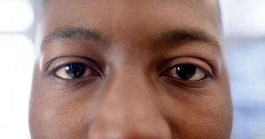 Afro-Amerikan bir adamın hastanedeki mutlu gözlerinin portresi, ağır çekimde. İlaç, sağlık ve sağlık hizmetleri, değiştirilmemiş.