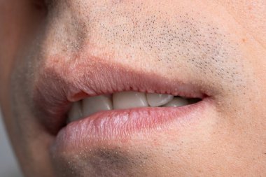 Kafkas erkek ağzı, dudakları ayrık, görünen beyaz dişler, temiz tıraşlı deri. Makro görüntüyü kapat, tanınmayan kişi..