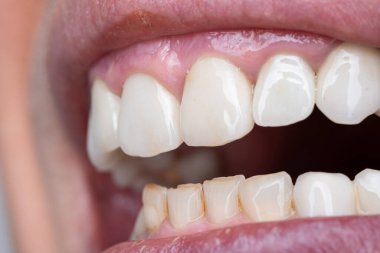 Kafkasyalı, ağzı açık, dişleri ve dişetleri açık, makro yakın çekim..