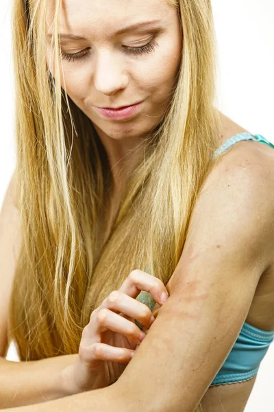 Picazón Piel Dermatitis Alergias Alimentarias Mujer Que Tiene Picazón Rascarse — Foto de Stock