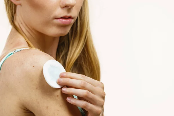 피부병 여드름 면직물 패드를 사용하여 피부를 청소하는 — 스톡 사진