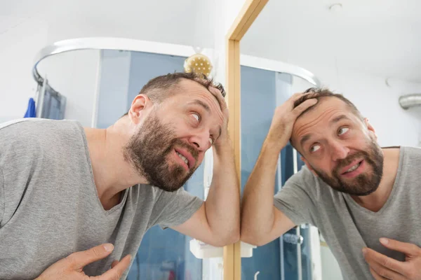Worried Adult Man Looking Bathroom Mirror His Decreasing Hairline Thinking — Stock Photo, Image