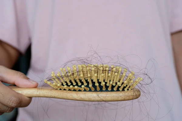 Hair fall in hairbrush stress problem of woman. Young woman holding a brush showing her comb brushing hair with long hair loss problem after brushing. Hair fell out of her hands in the living room.