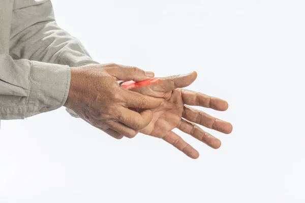 Quervain Pain Base Thumb Swelling Inflammation Tendon Thumb Wrist Hurt — Stockfoto