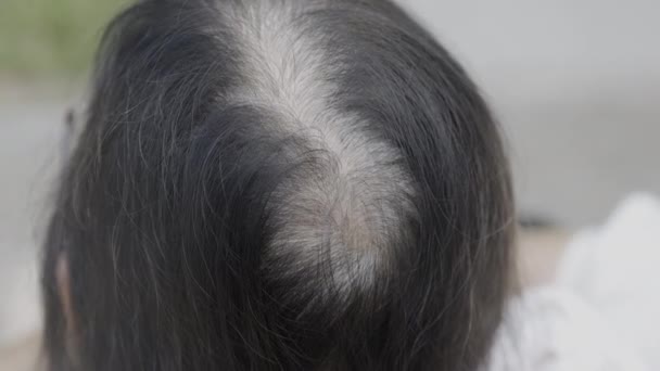 高齢のアジアの女性は閉経中の灰色の髪について懸念しています ストック映像