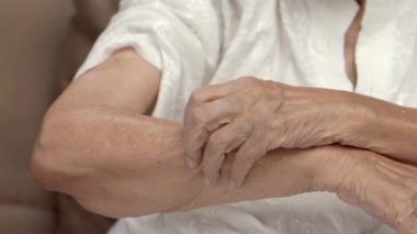 Yaşlı bir kadın kaşınıyor ve kolları kaşınıyor..