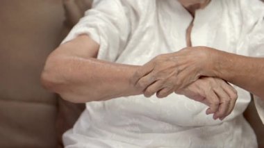 Yaşlı bir kadın kaşınıyor ve kolları kaşınıyor..