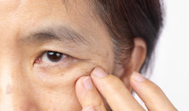 Kıdemli Asyalı kadın göz torbaları ve siyah noktalar için endişeleniyor..