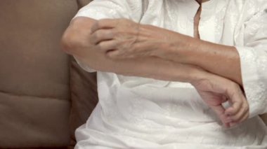 Yaşlı bir kadın kaşınıyor ve kolları kaşınıyor..