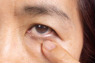 Üst düzey kadın göz yorgunluğundan sonra dijital ekranlarda uzun süre gerildi..