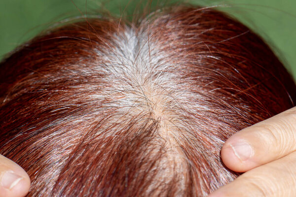 Senior aged asian woman concern about gray hair in menopause.