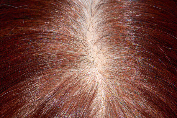 Senior aged asian woman concern about gray hair in menopause.