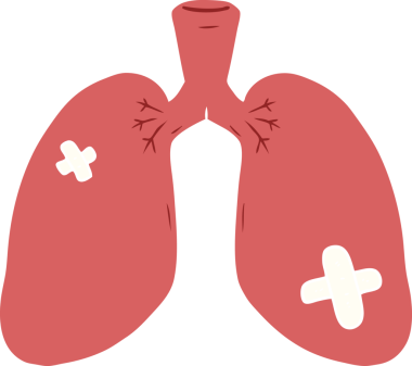 Orijinal düz renkli çizgi film akciğerleri onardı