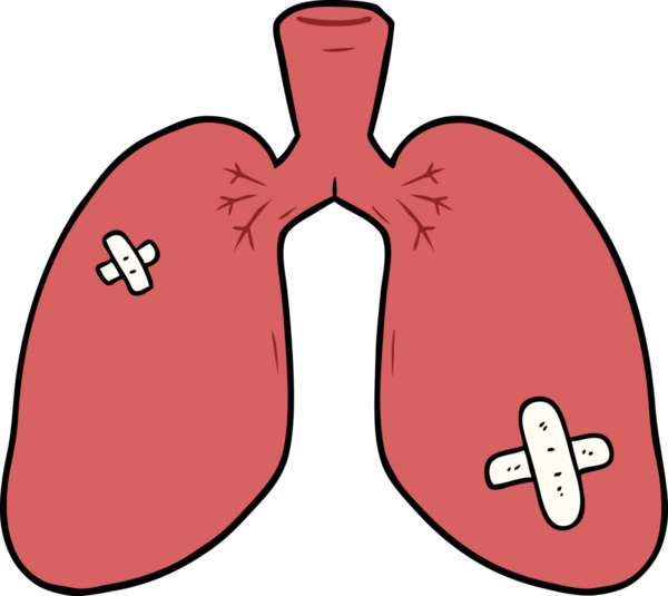 Karikatür bir insan tarafından çizilmiş akciğerleri onardı.