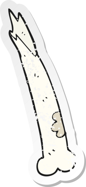Bir insan tarafından çizilmiş kırık bir kemiğin gerilimli retro yapıştırması.