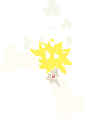 Bir insan tarafından çizilen kırık kemiğin düz renk çizimi