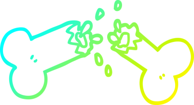 Bir insan tarafından çizilmiş kırık bir kemiğin soğuk gradyan çizimi.