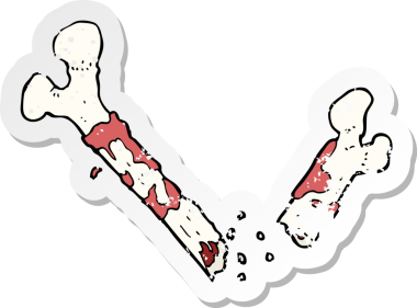 Bir insan tarafından çizilmiş iğrenç kırık kemik karikatürünün gerilimli retro yapıştırması