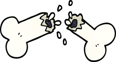 Bir insan tarafından çizilmiş kırık bir kemik.