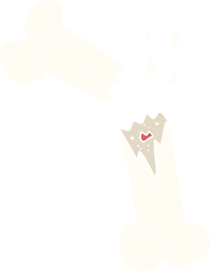 Bir insan tarafından çizilen kırık kemiğin düz renk çizimi