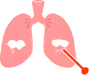 Düz renkli karikatür. Bir insan tarafından çizilmiş sağlıksız akciğerler.