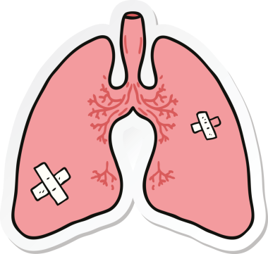 Bir insan tarafından çizilmiş bir karikatür akciğerinin çıkartması.