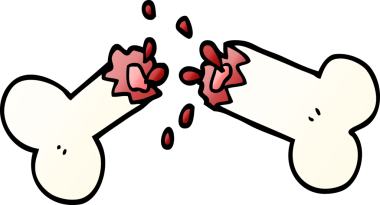 Bir insan tarafından çizilmiş kırık bir kemik.