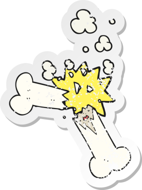 Bir insan tarafından çizilmiş kırık bir kemiğin gerilimli retro yapıştırması.