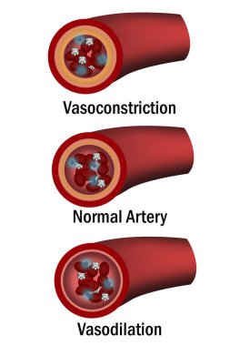 Comparison of normal, vasoconstriction and vasodilation blood vessels with cross section of arteries, 3d rende clipart