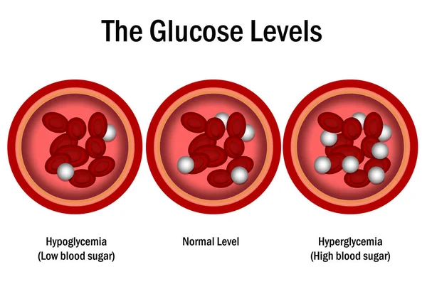 Blood Glucose Levels Normal Level Hyperglycemia Hypoglycemia Rendering — Stock Photo, Image
