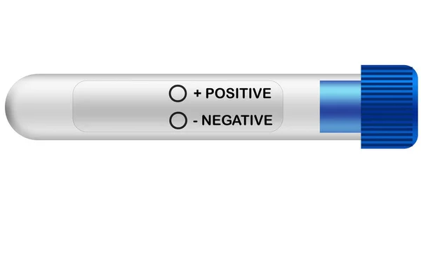 Üres Kémcső Pozitív Negatív Kiválasztással Kiolvasztás — Stock Fotó