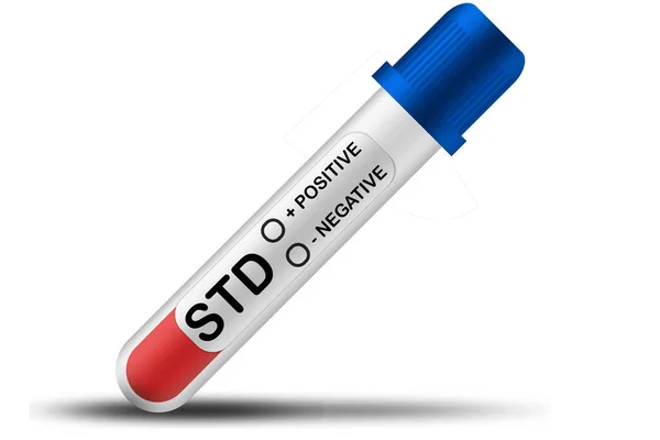 Std Test Tüpü Beyaz Arkaplanlı Görüntüleme — Stok fotoğraf