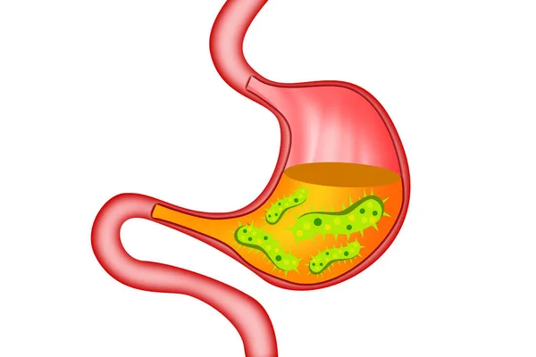 人間の胃の中のウイルスや細菌 3Dレンダリング — ストック写真