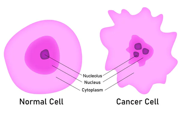Nádorové Buňky Srovnání Normálními Buňkami Vykreslování — Stock fotografie