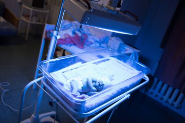 Yeni doğmuş bebek. Bebek, doğum hastanesinde mavi bir lambanın altında yatıyor. Yeni doğan sarılığın tedavisi