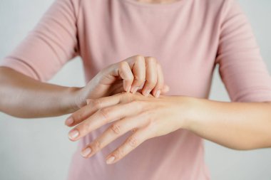 Pembe gömlekli bir kadın elini kaşıyor. Elinde isilik var ve kaşıntısını gidermeye çalışıyor.