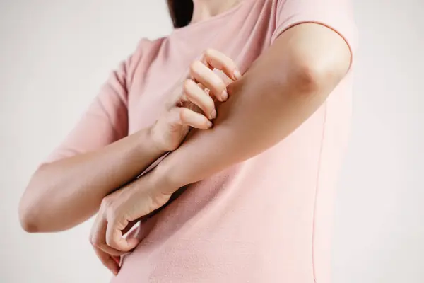 Pembe gömlekli bir kadın kolunu kaşıyor. Rahatsızlık ve rahatsızlık kavramı