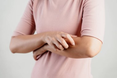 Pembe gömlekli bir kadın kolunu kaşıyor. Kolunda kızarıklık var ve kaşıntısını gidermeye çalışıyor.
