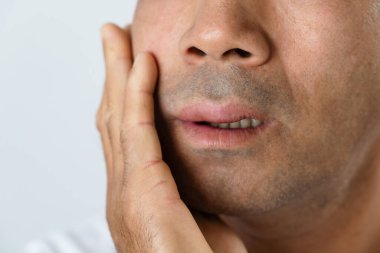 Adamın yüzünde böcek ısırığı, yemek ya da ilaç gibi tetikleyicilere karşı alerjik reaksiyon nedeniyle şişlik var. Şişmiş bir suratı kapat..