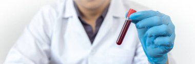 Bilim insanları veya doktorlar, virüs konseptini ortadan kaldırmak için araştırma laboratuvarında analiz ve aşı için yeni virüs türlerinden kan örnekleri topluyorlar..