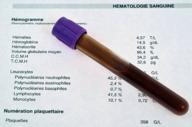 Kan hematolojisindeki kan tüpü Fransızca yazılmış.