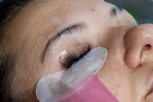 Mujer Encuentra Con Los Ojos Cerrados Cubierto Con Almohadillas Silicona —  Fotos de Stock